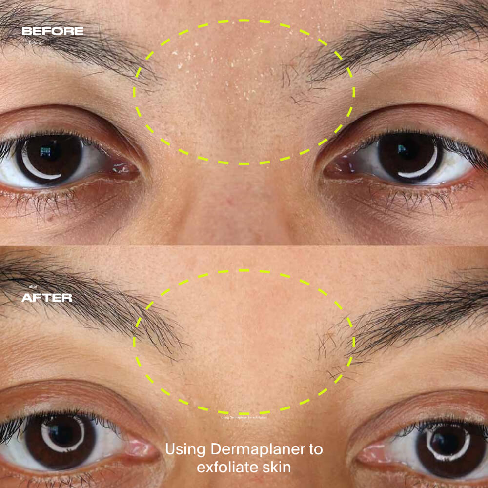 Leaf Dermaplaner Kit